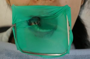 %e3%83%a9%e3%83%90%e3%83%bc%e3%83%80%e3%83%a0